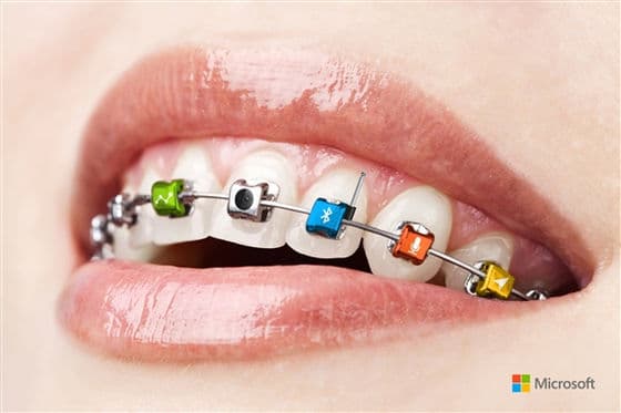 Microsoft Braces.jpg-550x0