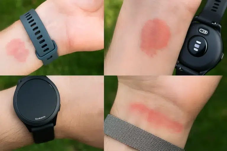 Garmin-Uhr verursacht Hautreizungen? Das steckt wirklich dahinter