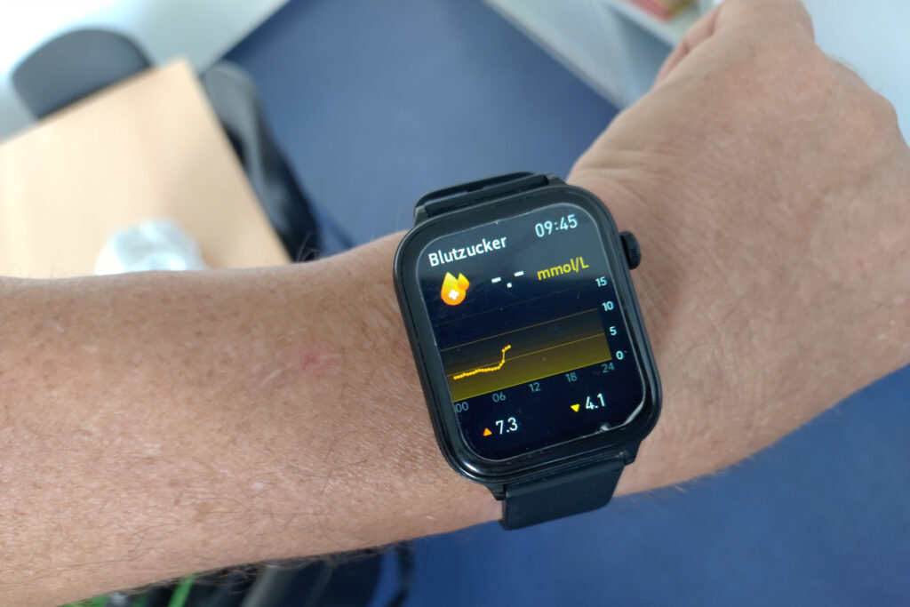 Smartwatch misst Blutzucker? Warum du dich nicht täuschen lassen solltest